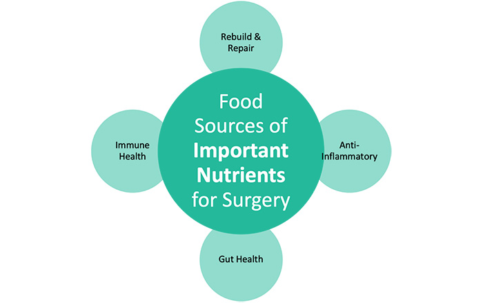 Infographic: food sources of important nutrients for surgery, covering rebuild and repair, anti-inflammatory support, gut health, and immune health